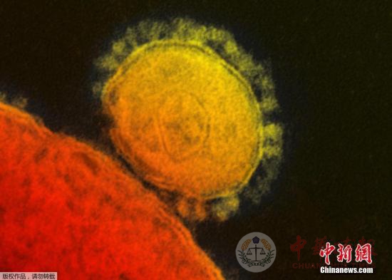 台北疑似MERS患者排除感染 实为流感